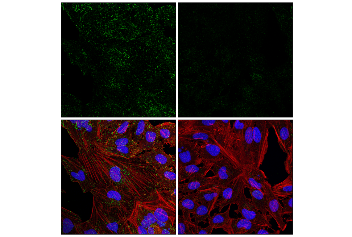Immunofluorescence Image 3: Numb (C29G11) Rabbit mAb