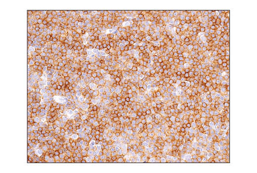 Immunohistochemistry Image 3: CD47 (D3O7P) Rabbit mAb
