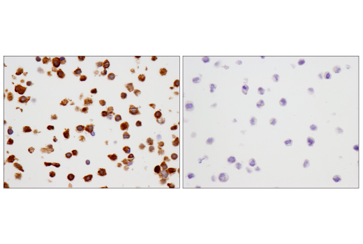 Immunohistochemistry Image 4: SMAD4 (D3R4N) XP<sup>®</sup> Rabbit mAb (BSA and Azide Free)