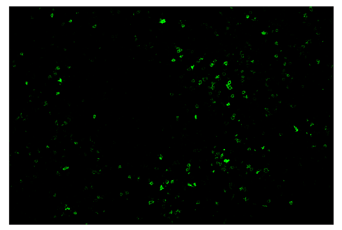 Immunohistochemistry Image 1: OX40 (E9U7O) & CO-0086-488 SignalStar<sup>™</sup> Oligo-Antibody Pair