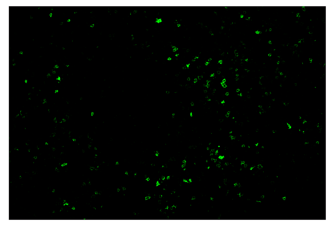 Immunohistochemistry Image 1: OX40 (E9U7O) & CO-0086-594 SignalStar™ Oligo-Antibody Pair