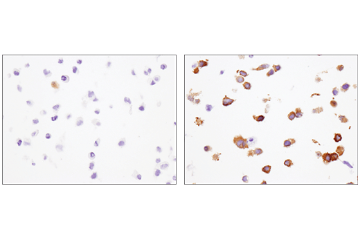 Immunohistochemistry Image 2: IFIT1 (D2X9Z) Rabbit mAb