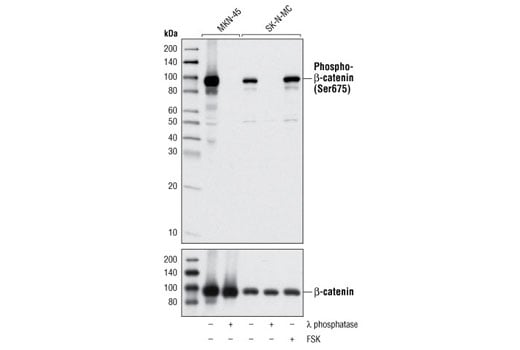 Western Blotting Image 2: Phospho-β-Catenin (Ser675) (D2F1) XP<sup>®</sup> Rabbit mAb (BSA and Azide Free)