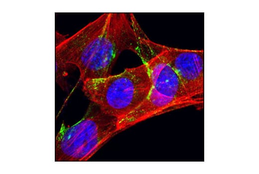 Immunofluorescence Image 1: Caveolin-1 (D46G3) XP<sup>®</sup> Rabbit mAb