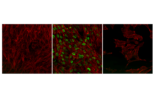 Immunofluorescence Image 1: NRF2 (D1Z9C) XP<sup>®</sup> Rabbit mAb (BSA and Azide Free)