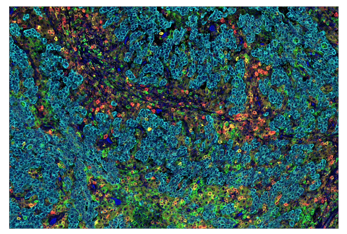 Immunohistochemistry Image 1: Phospho-SLP-76 (Ser376) (E3G9U) & CO-0018-750 SignalStar<sup>™</sup> Oligo-Antibody Pair