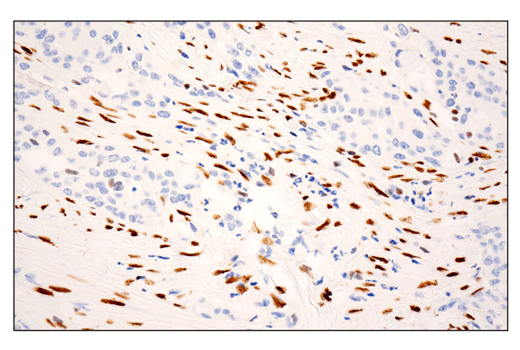 undefined Image 51: Epithelial-Mesenchymal Transition (EMT) IF Antibody Sampler Kit