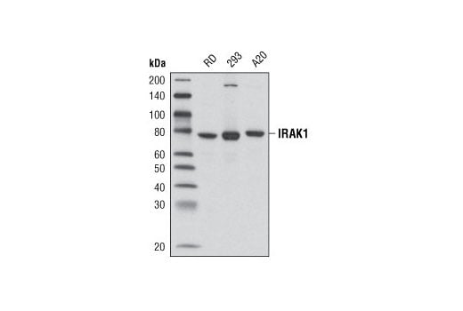 Western Blotting Image 1: IRAK1 (D51G7) Rabbit mAb