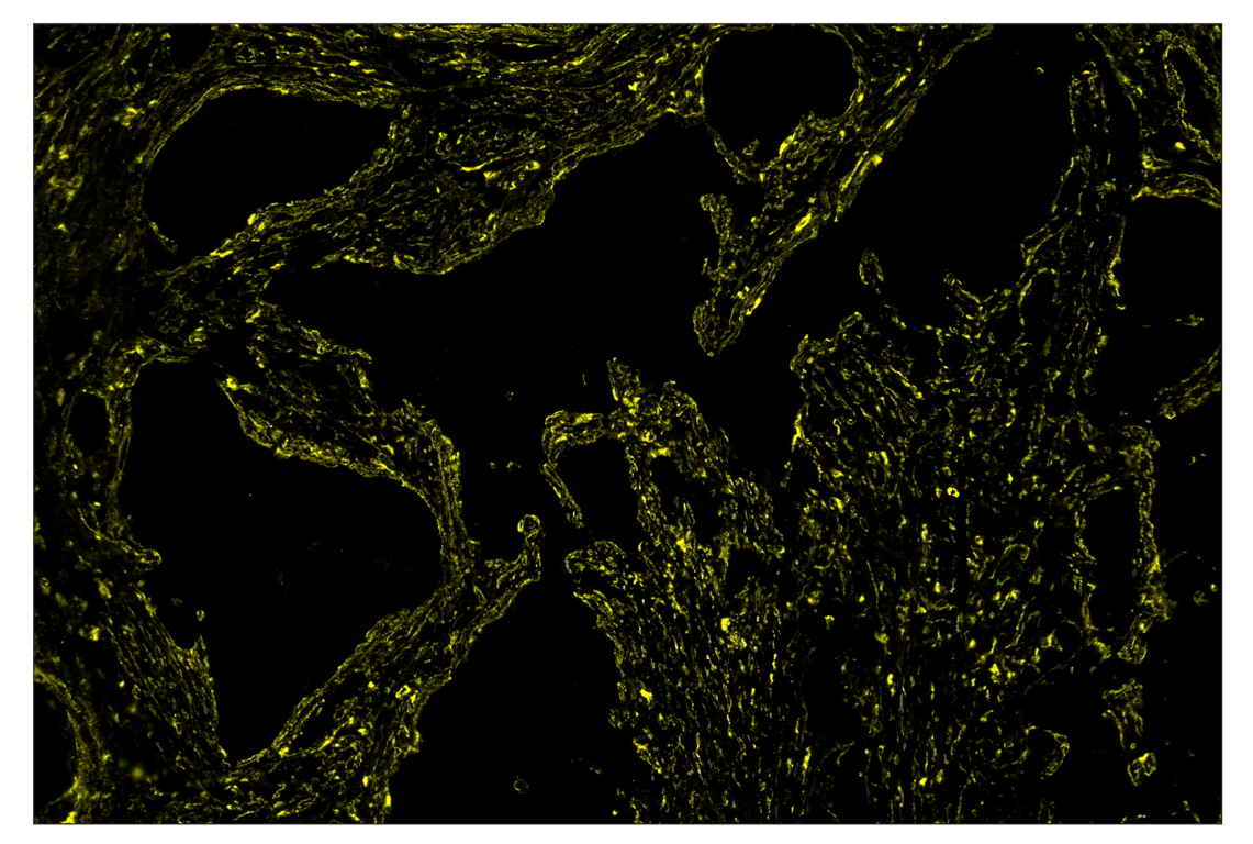 Immunohistochemistry Image 4: α-Smooth Muscle Actin (D4K9N) & CO-0024-488 SignalStar<sup>™</sup> Oligo-Antibody Pair