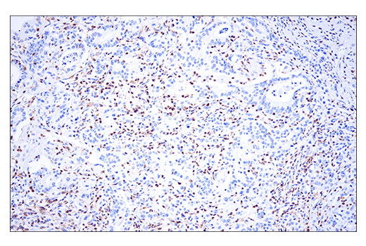 Immunohistochemistry Image 3: HPK1 (E1C3L) Rabbit mAb (BSA and Azide Free)