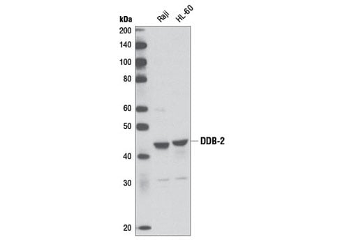undefined Image 8: Ubiquitin E3 Ligase Complex Antibody Sampler Kit