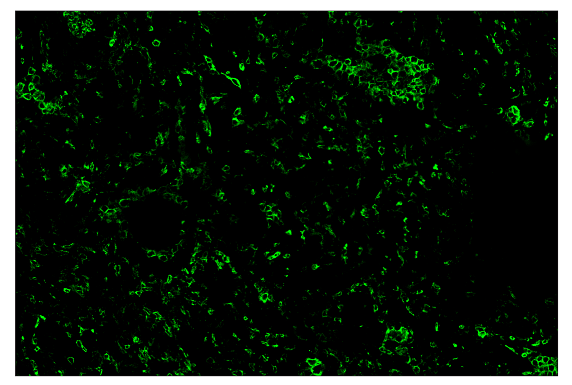 Immunohistochemistry Image 2: CD11b/ITGAM (D6X1N) & CO-0037-750 SignalStar<sup>™</sup> Oligo-Antibody Pair