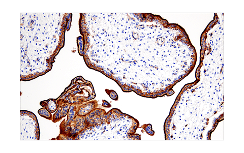 Immunohistochemistry Image 3: CD200 (E5I9V) XP<sup>®</sup> Rabbit mAb