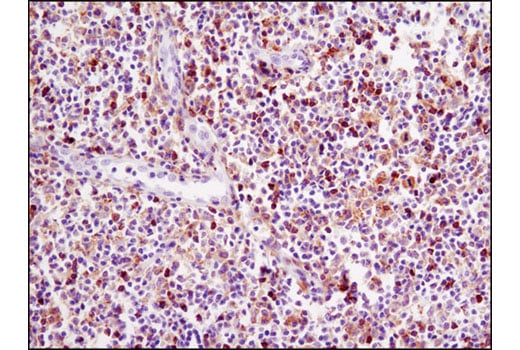 undefined Image 7: PhosphoPlus<sup>®</sup> Btk (Tyr223) Antibody Duet