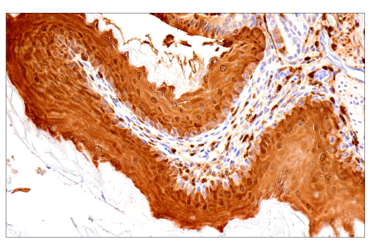 Immunohistochemistry Image 5: Galectin-3/LGALS3 (E7B6R) Rabbit mAb
