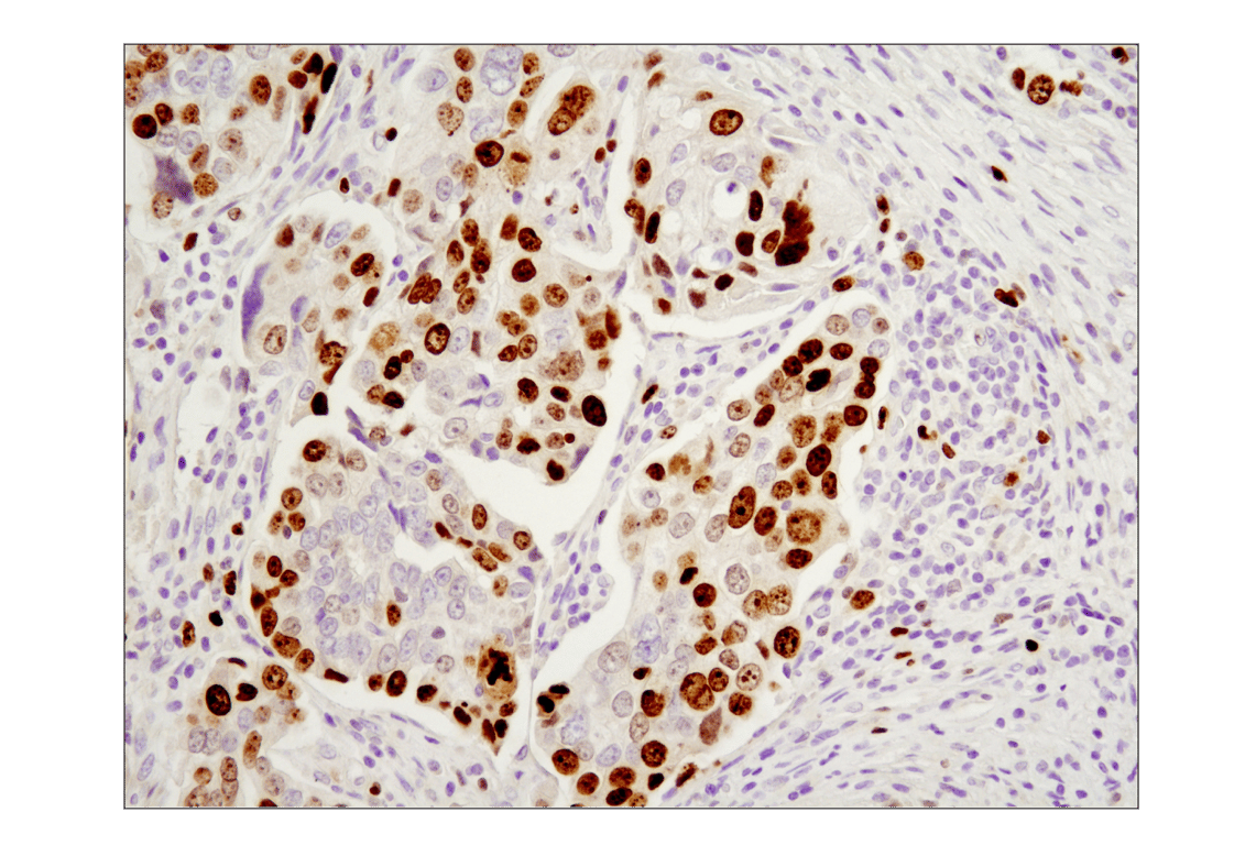 Immunohistochemistry Image 1: Ki-67 (D2H10) Rabbit mAb (BSA and Azide Free)