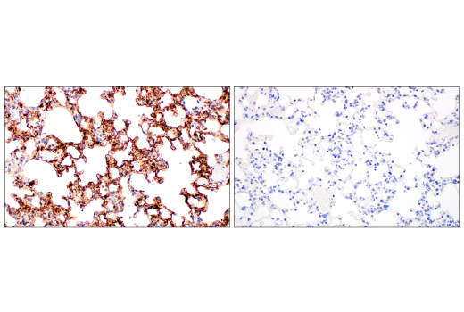 Immunohistochemistry Image 2: SARS-CoV-2 Nucleocapsid Protein (E9L7H) XP<sup>®</sup> Rabbit mAb