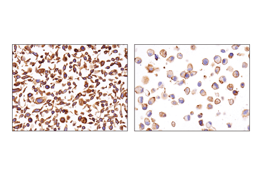 undefined Image 14: Glutamine Metabolism Antibody Sampler Kit