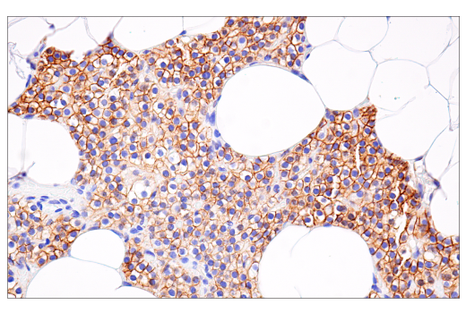 Immunohistochemistry Image 9: β-Catenin (15B8) Mouse mAb