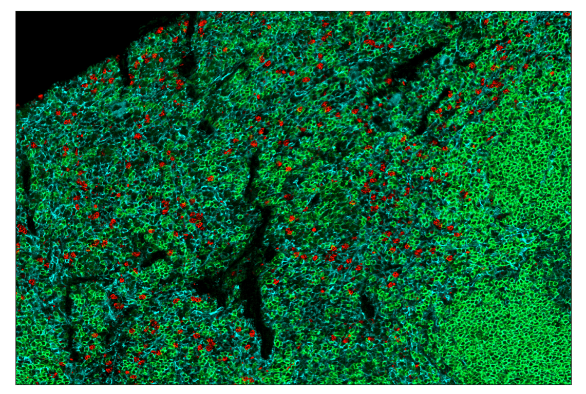 Immunohistochemistry Image 6: CD19 (Intracellular Domain) (D4V4B) & CO-0054-488 SignalStar<sup>™</sup> Oligo-Antibody Pair