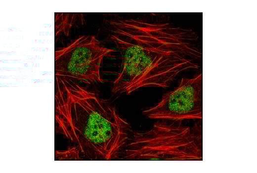 Immunofluorescence Image 1: HDAC3 (7G6C5) Mouse mAb
