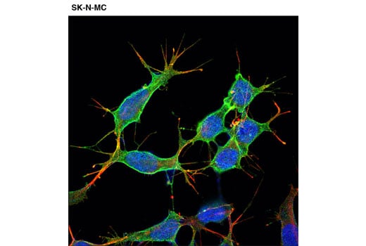 Immunofluorescence Image 1: p75NTR (D4B3) XP<sup>®</sup> Rabbit mAb (BSA and Azide Free)