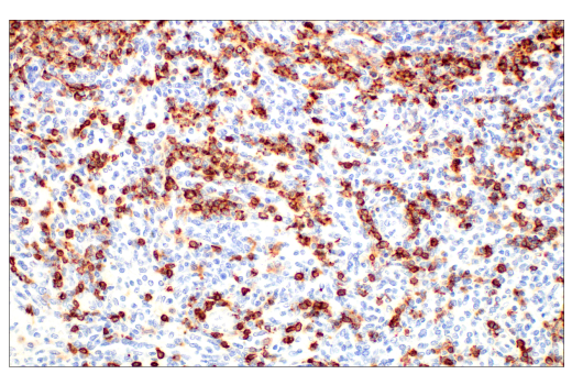 Immunohistochemistry Image 6: CD20 (E7B7T) XP<sup>®</sup> Rabbit mAb