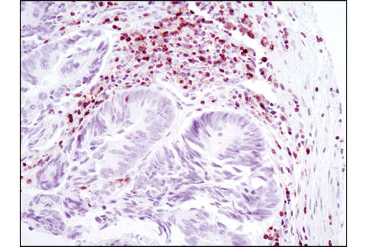 Immunohistochemistry Image 2: NFAT1 (D43B1) XP<sup>®</sup> Rabbit mAb (BSA and Azide Free)