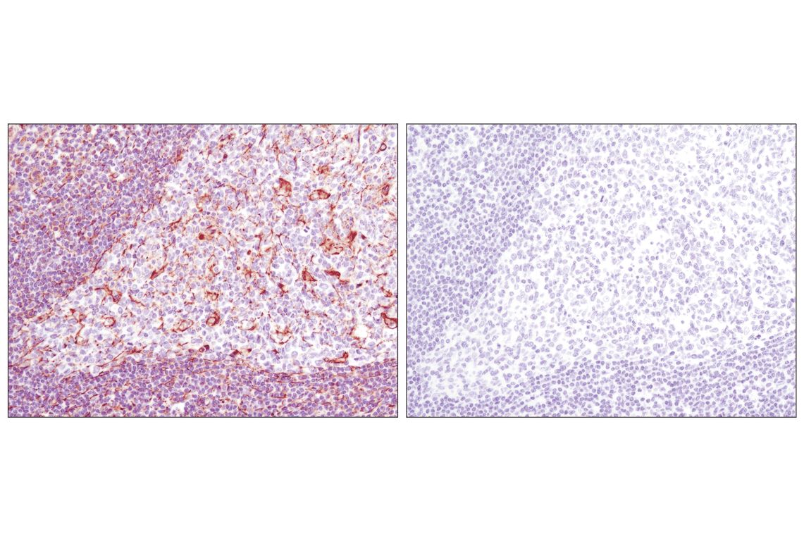 undefined Image 48: Cell Fractionation Antibody Sampler Kit