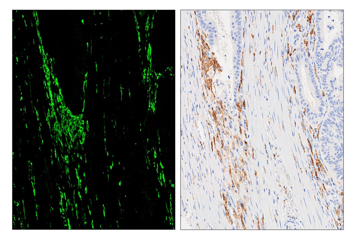 Immunohistochemistry Image 6: HLA-DRA (E9R2Q) & CO-0023-488 SignalStar<sup>™</sup> Oligo-Antibody Pair