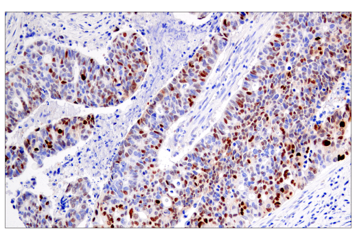 Immunohistochemistry Image 1: Cyclin D1 (E3P5S) XP<sup>®</sup> Rabbit mAb (BSA and Azide Free)