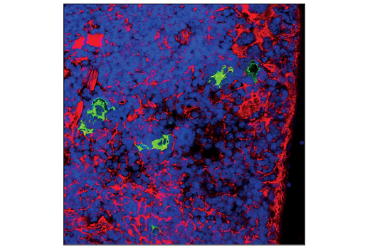 Immunofluorescence Image 1: PD-1 (Intracellular Domain) (D7D5W) XP<sup>®</sup> Rabbit mAb