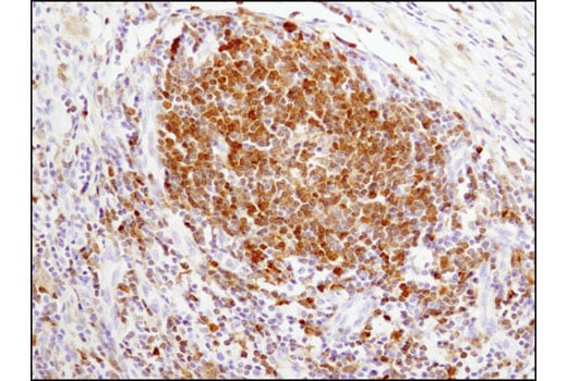 Immunohistochemistry Image 3: Syk (D3Z1E) XP<sup>®</sup> Rabbit mAb (BSA and Azide Free)