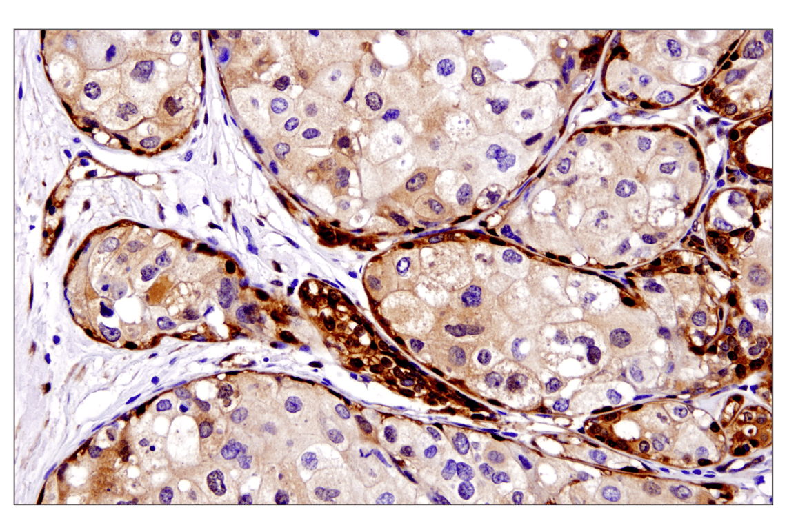 Immunohistochemistry Image 2: YAP (D8H1X) XP<sup>®</sup> Rabbit mAb