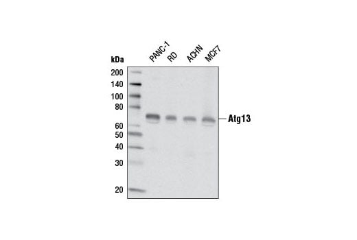 Western Blotting Image 1: Atg13 (E1Y9V) Rabbit mAb