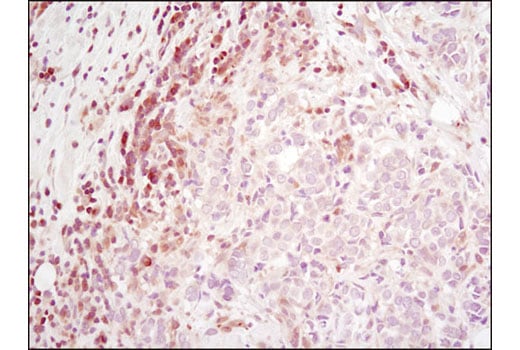 Immunohistochemistry Image 1: RSK2 (D21B2) XP<sup>®</sup> Rabbit mAb (BSA and Azide Free)