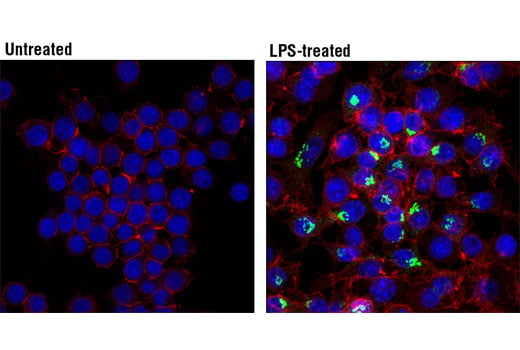 Immunofluorescence Image 1: IL-6 (D5W4V) XP<sup>®</sup> Rabbit mAb