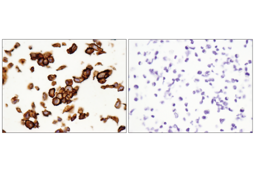 Immunohistochemistry Image 4: CD44 (E7K2Y) XP<sup>®</sup> Rabbit mAb (BSA and Azide Free)