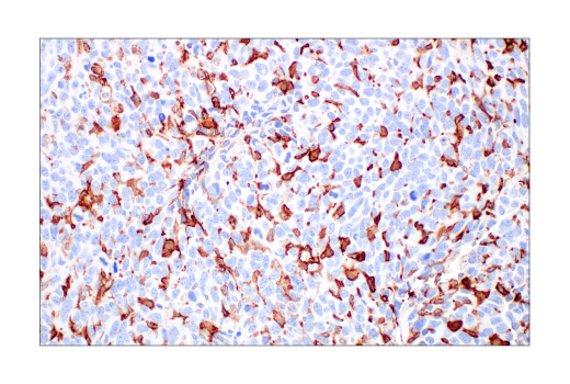 undefined Image 54: Mouse Reactive M1 vs M2 Macrophage IHC Antibody Sampler Kit