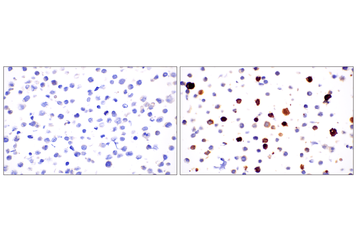 Immunohistochemistry Image 8: PNPLA3 (E7N6O) Rabbit mAb (BSA and Azide Free)