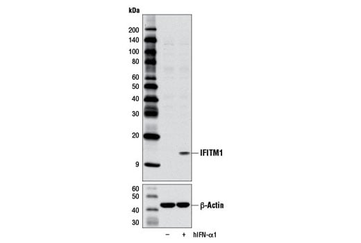 undefined Image 19: Host Cell Viral Restriction Factor Antibody Sampler Kit