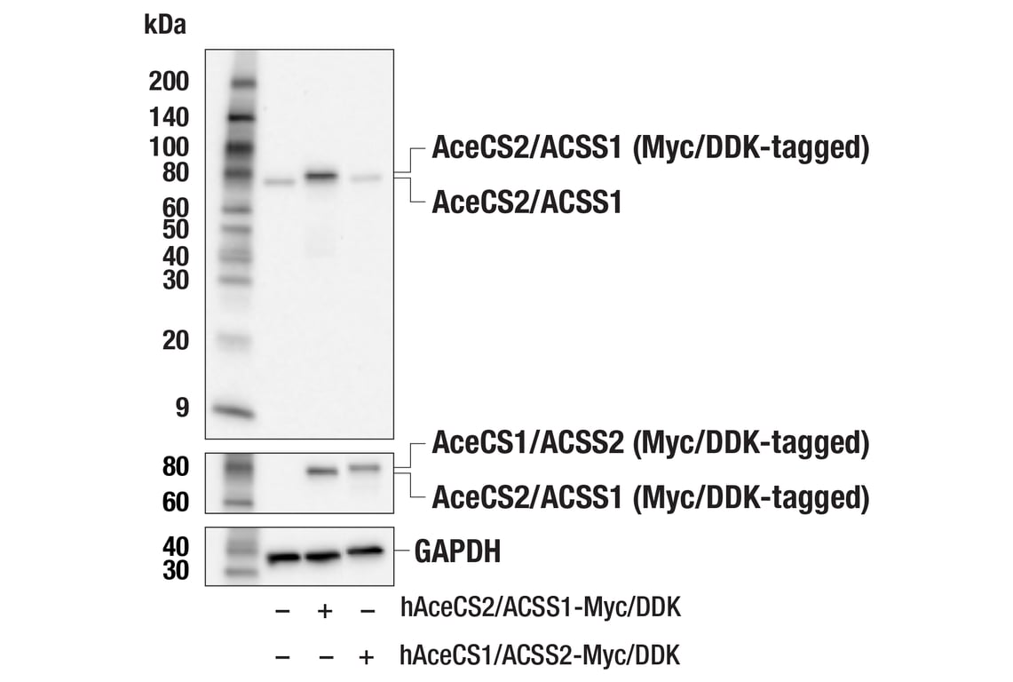 Western Blotting Image 2: AceCS2/ACSS1 (E6T5E) Rabbit mAb