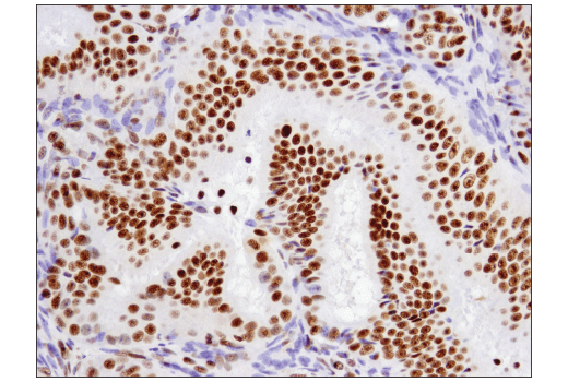 Immunohistochemistry Image 3: ATF-2 (D4L2X) XP<sup>®</sup> Rabbit mAb (BSA and Azide Free)