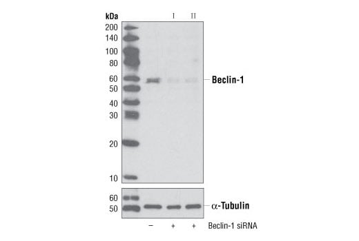 undefined Image 1: SignalSilence<sup>®</sup> Beclin-1 siRNA I