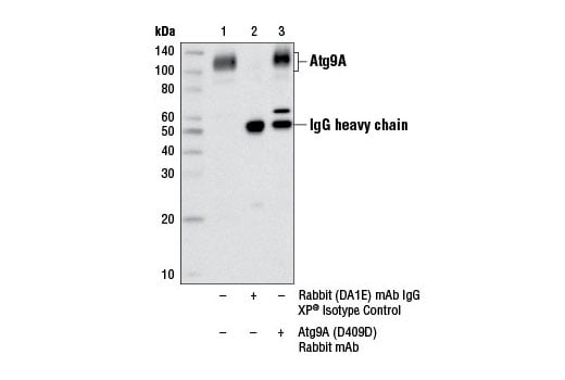 undefined Image 16: Autophagy Vesicle Nucleation Antibody Sampler Kit