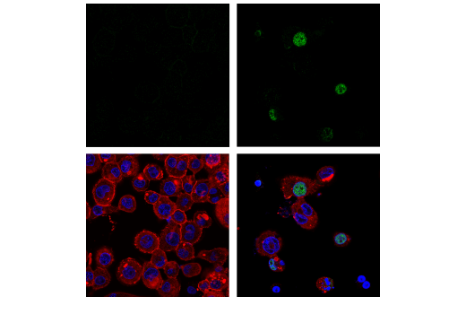 Immunofluorescence Image 1: Phospho-IRF-3 (Ser386) (E7J8G) XP<sup>®</sup> Rabbit mAb