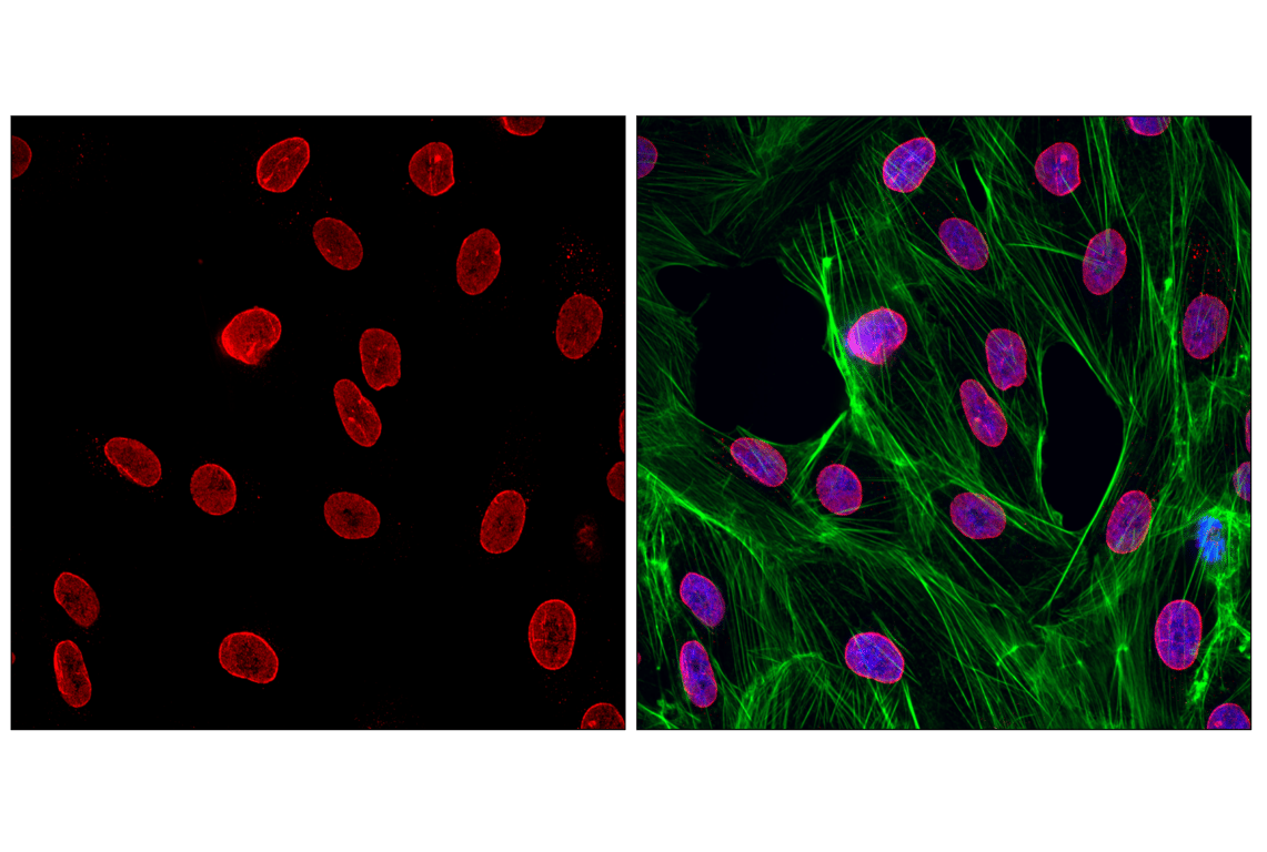 Immunofluorescence Image 1: NUP98 (C39A3) Rabbit mAb (Alexa Fluor<sup>®</sup> 555 Conjugate)