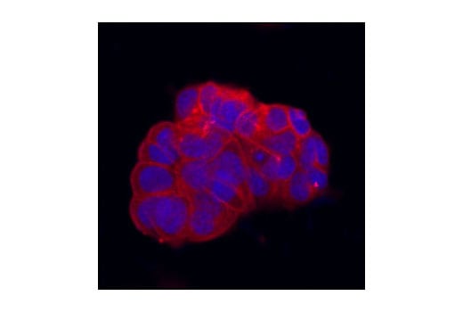 Immunofluorescence Image 1: Src (36D10) Rabbit mAb