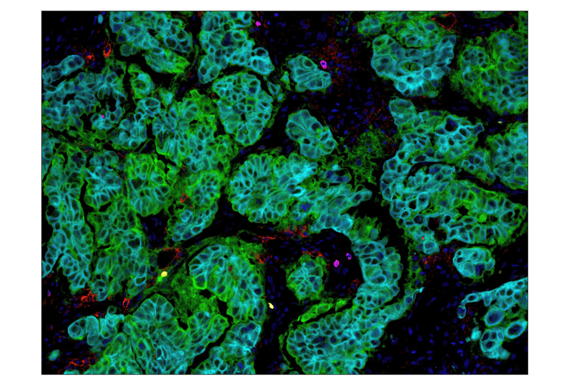 Immunohistochemistry Image 4: PD-L1 (E1L3N<sup>®</sup>) XP<sup>®</sup> Rabbit mAb (BSA and Azide Free)