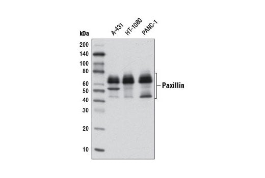 undefined Image 1: PhosphoPlus<sup>®</sup> Paxillin (Tyr118) Antibody Duet